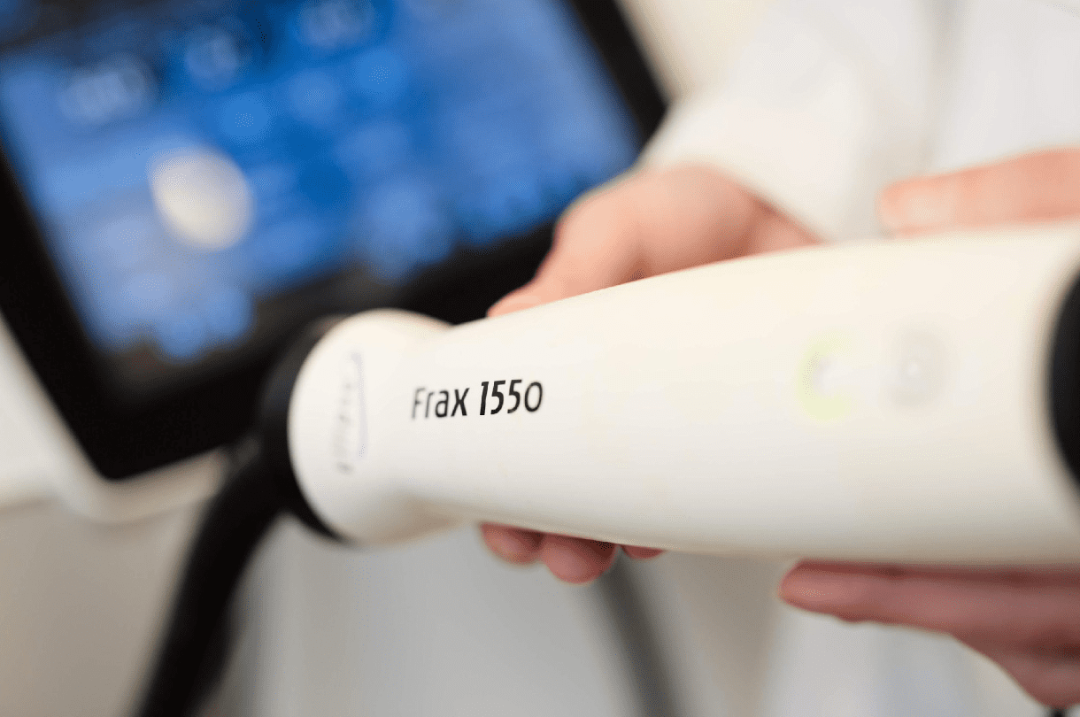 Frax 1500 laser treatments