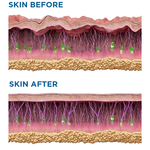 a cartoon image of the effects of Exion on the skin